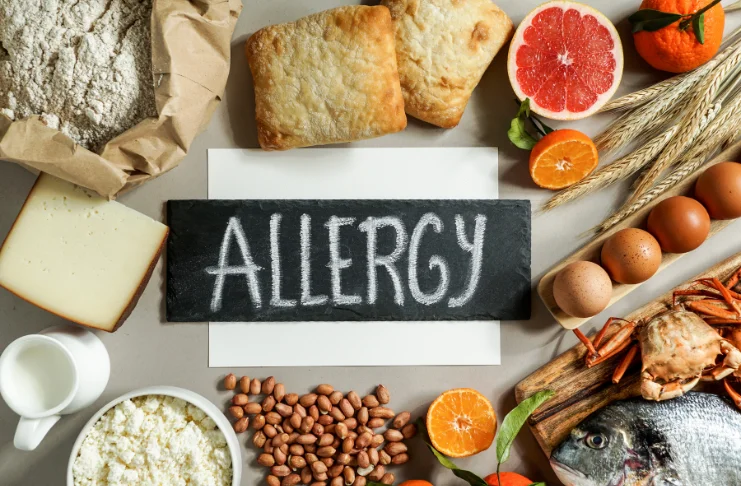 Allergen Information and Food Hygiene Standards